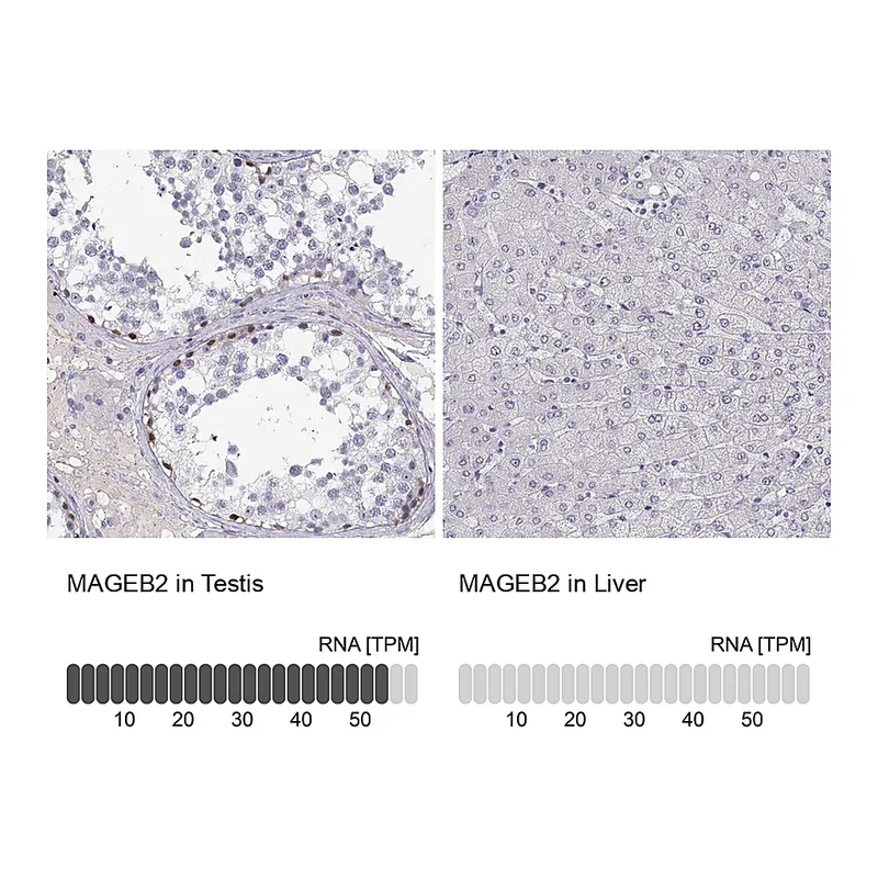 Atlas Antibodies Anti-MAGEB2 Antibody