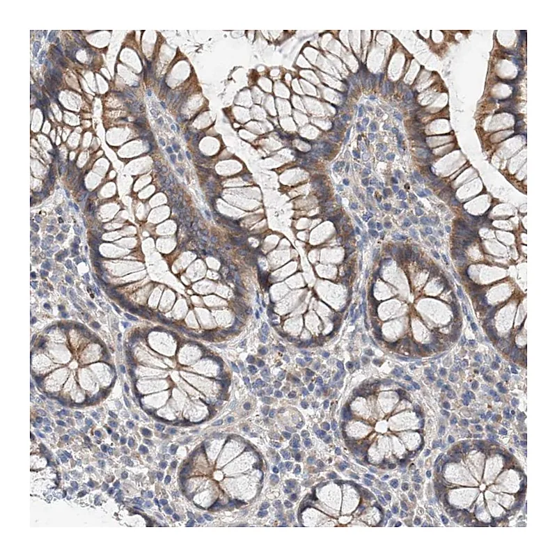 Atlas Antibodies Anti-MAGEE2 Antibody
