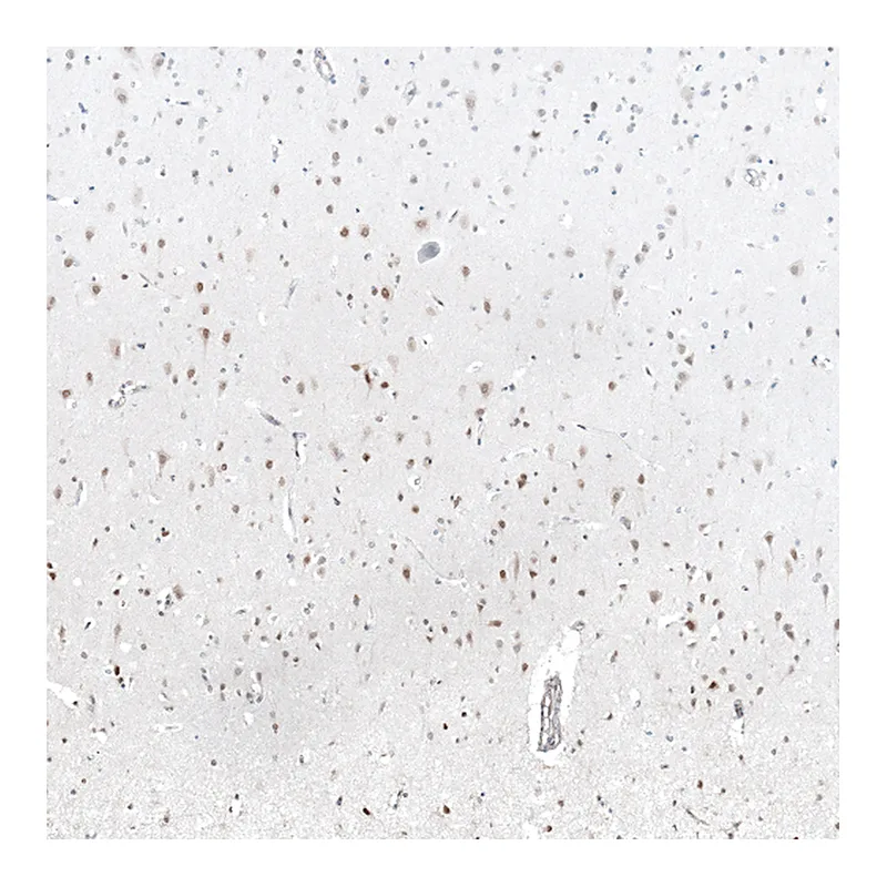 Atlas Antibodies Anti-MAGED4B Antibody