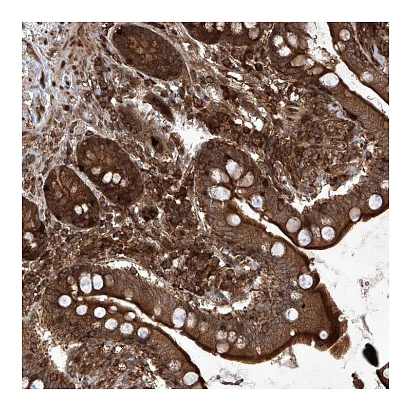 Atlas Antibodies Anti-MAGED2 Antibody