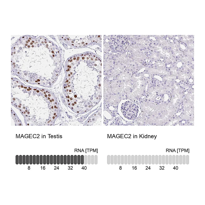 Atlas Antibodies Anti-MAGEC2 Antibody
