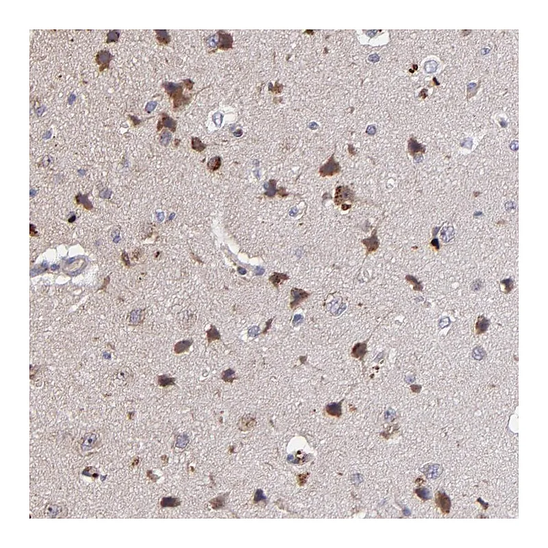 Atlas Antibodies Anti-MAGEE1 Antibody