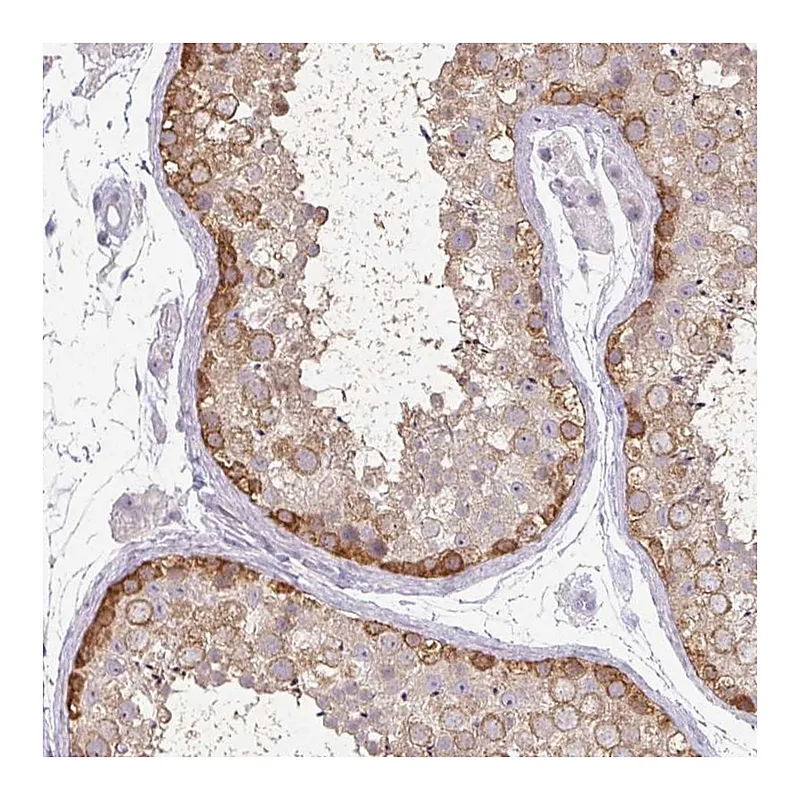 Atlas Antibodies Anti-MAGEC3 Antibody