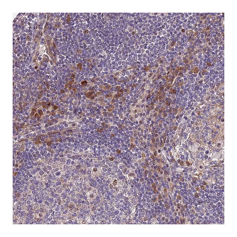 Atlas Antibodies Anti-MAGEF1 Antibody