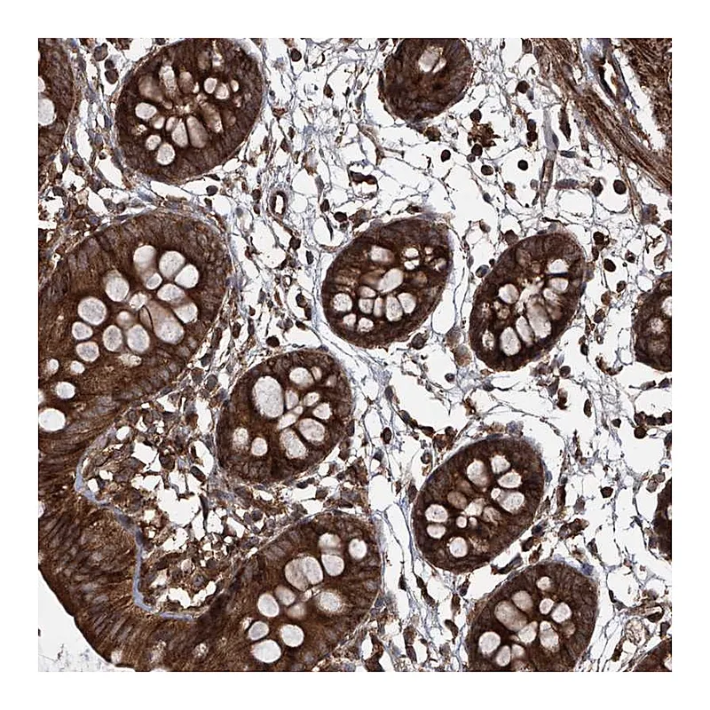 Atlas Antibodies Anti-MAGED2 Antibody