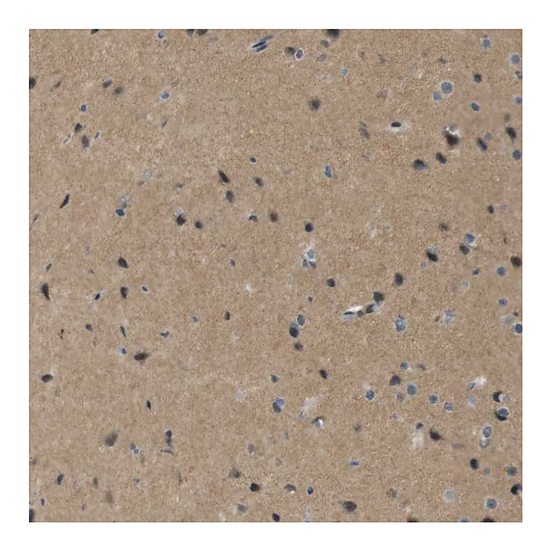 Atlas Antibodies Anti-MAGI2 Antibody
