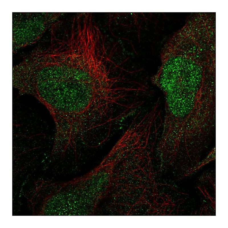 Atlas Antibodies Anti-MAGI1 Antibody