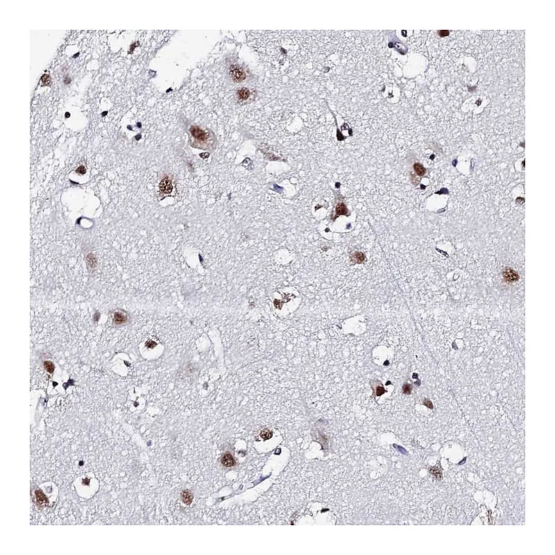 Atlas Antibodies Anti-MAGOH Antibody