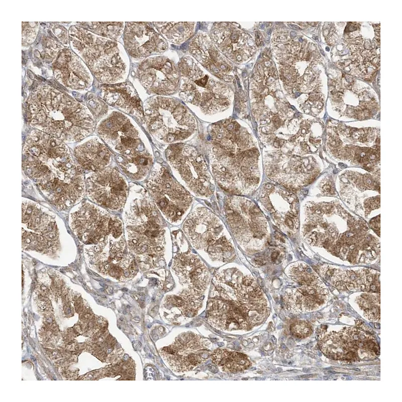 Atlas Antibodies Anti-MAGIX Antibody