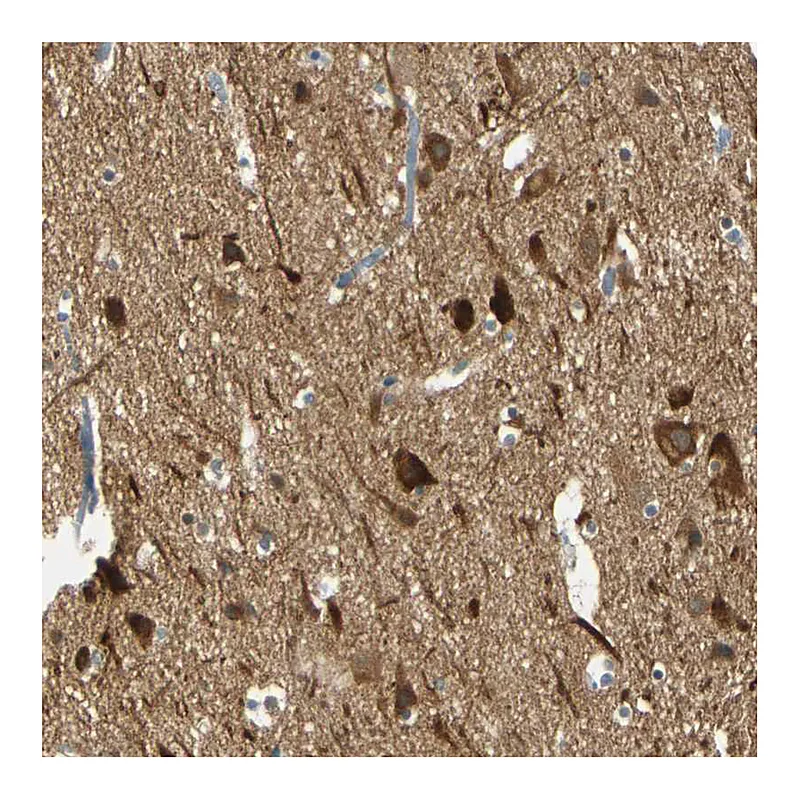 Atlas Antibodies Anti-MAGI3 Antibody