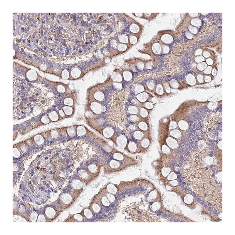 Atlas Antibodies Anti-MALRD1 Antibody
