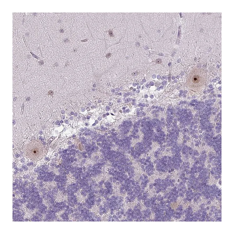 Atlas Antibodies Anti-MAK16 Antibody