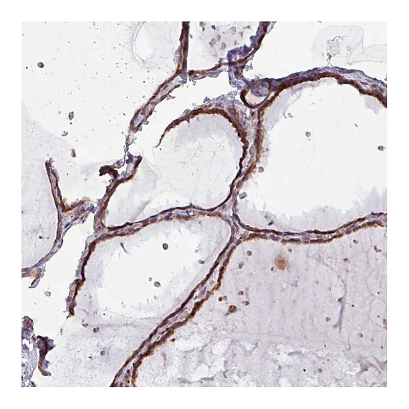 Atlas Antibodies Anti-MAGT1 Antibody