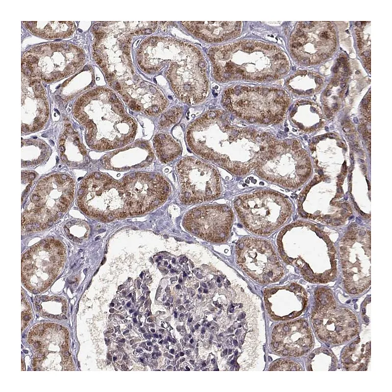 Atlas Antibodies Anti-MAIP1 Antibody