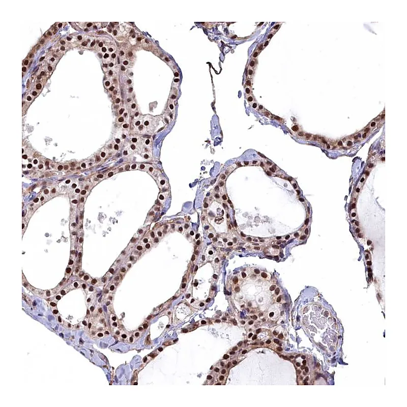 Atlas Antibodies Anti-MAK16 Antibody
