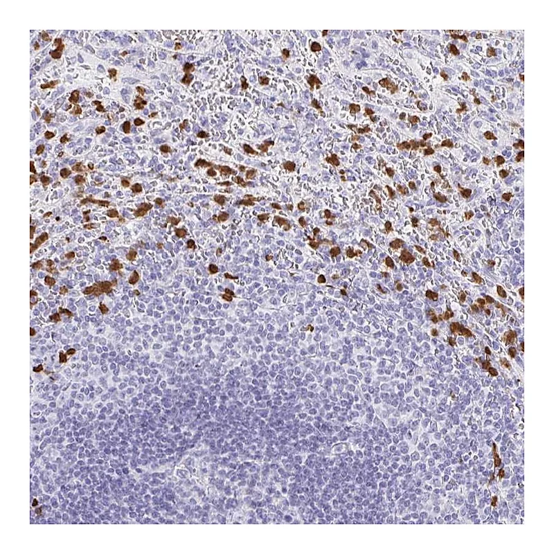 Atlas Antibodies Anti-MAMDC4 Antibody