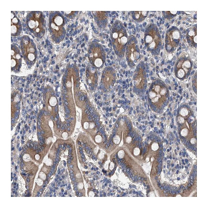 Atlas Antibodies Anti-MAMDC2 Antibody