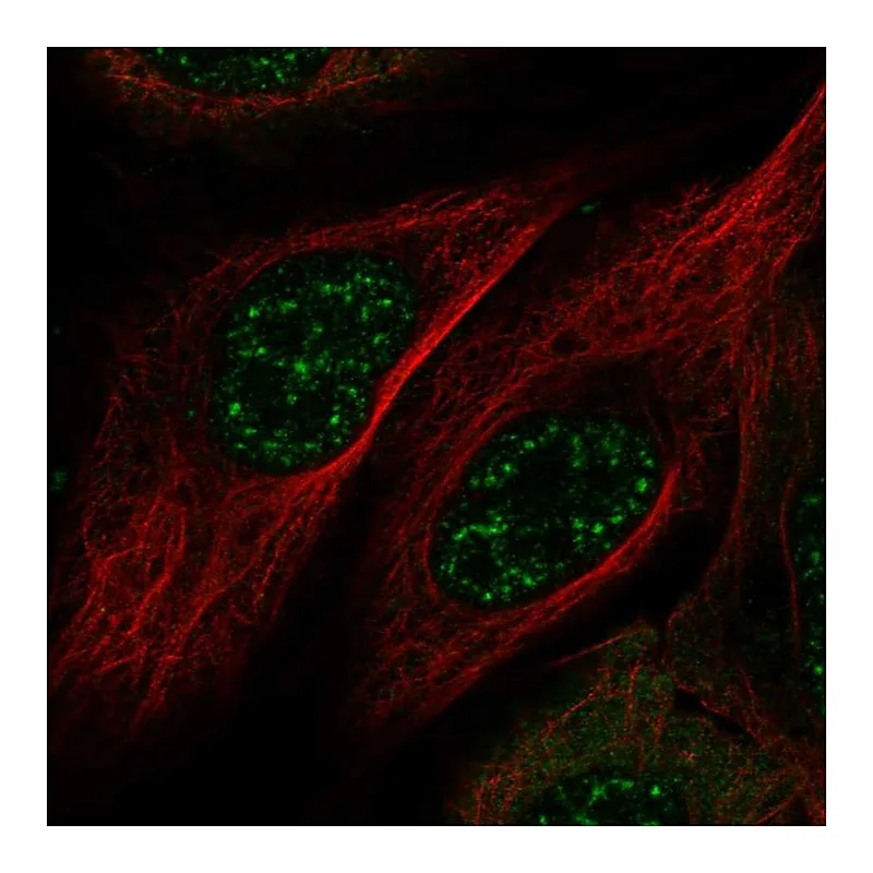 Atlas Antibodies Anti-MAMSTR Antibody