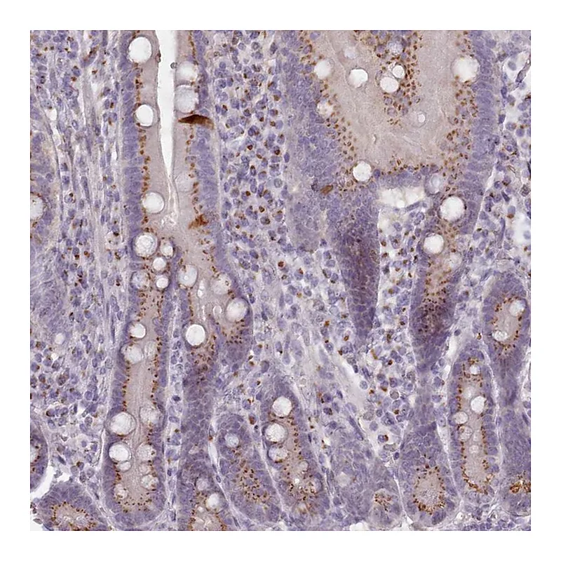 Atlas Antibodies Anti-MAN1B1 Antibody