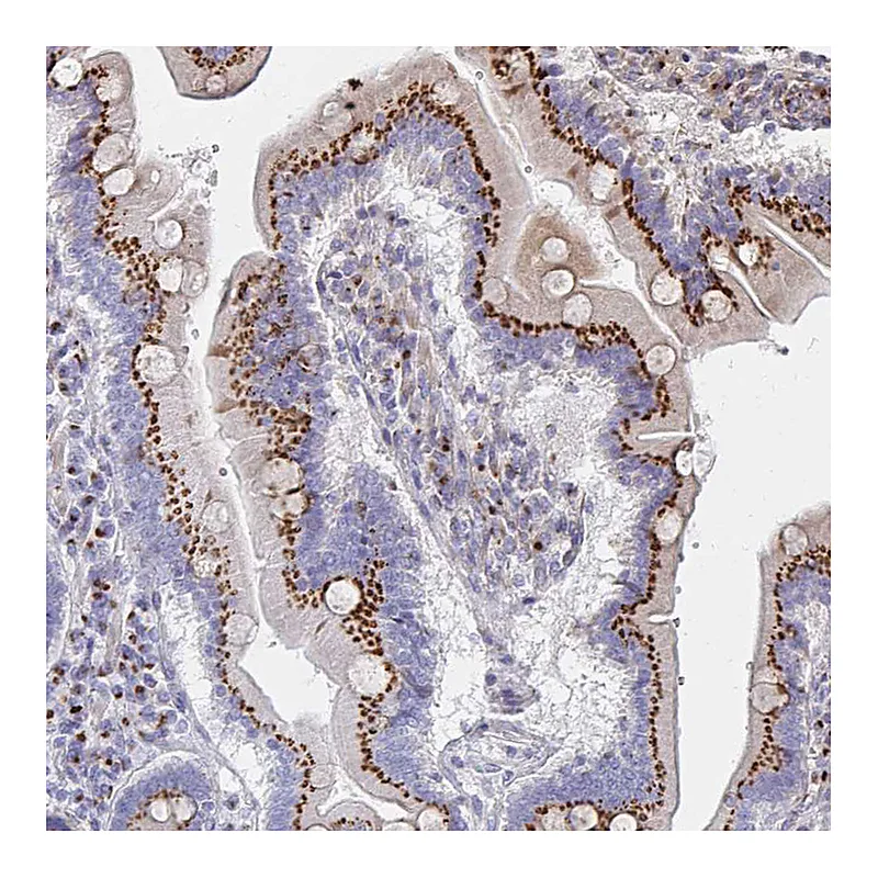Atlas Antibodies Anti-MAN1A1 Antibody