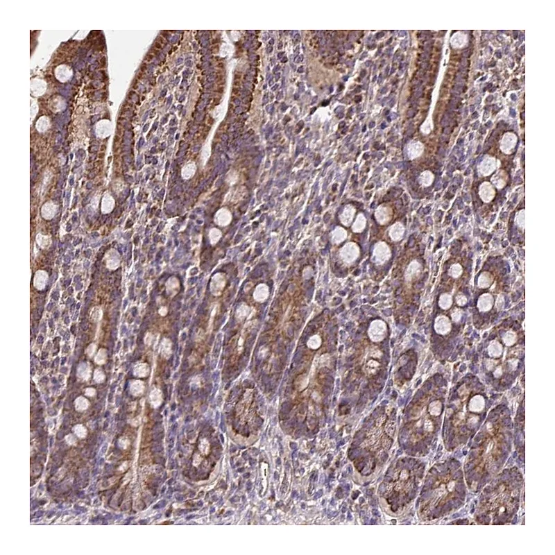 Atlas Antibodies Anti-MAN1A1 Antibody