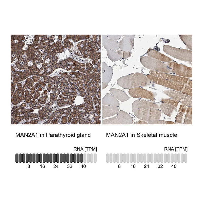 Atlas Antibodies Anti-MAN2A1 Antibody