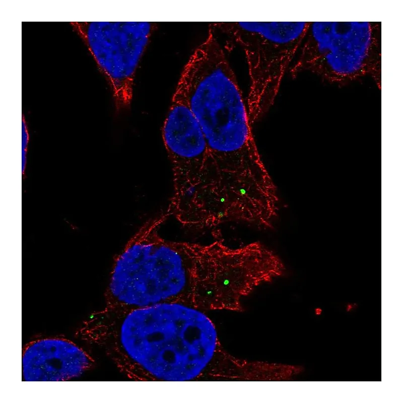 Atlas Antibodies Anti-MAN2A2 Antibody