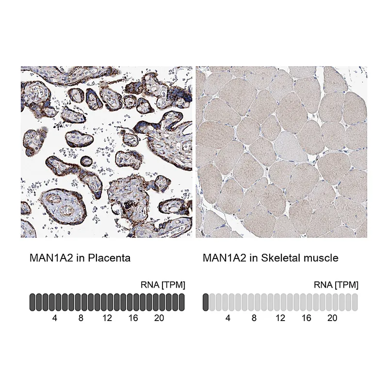 Atlas Antibodies Anti-MAN1A2 Antibody