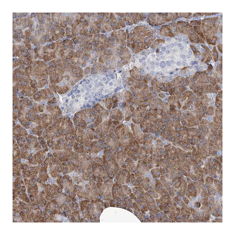 Atlas Antibodies Anti-MAN2B2 Antibody