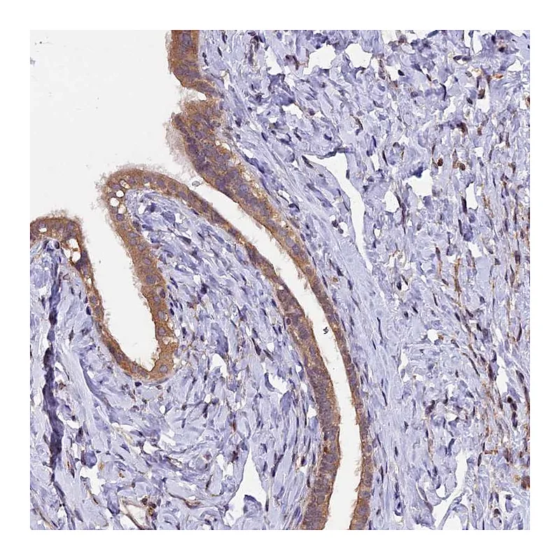 Atlas Antibodies Anti-MAN2C1 Antibody