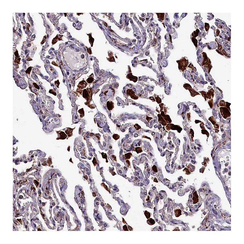 Atlas Antibodies Anti-MAN2B1 Antibody