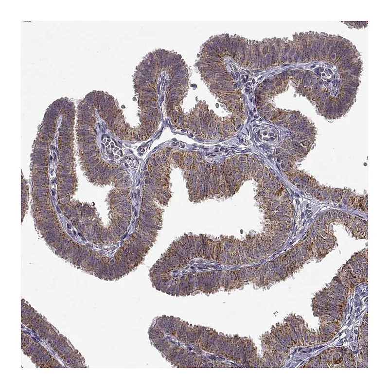 Atlas Antibodies Anti-MANBAL Antibody