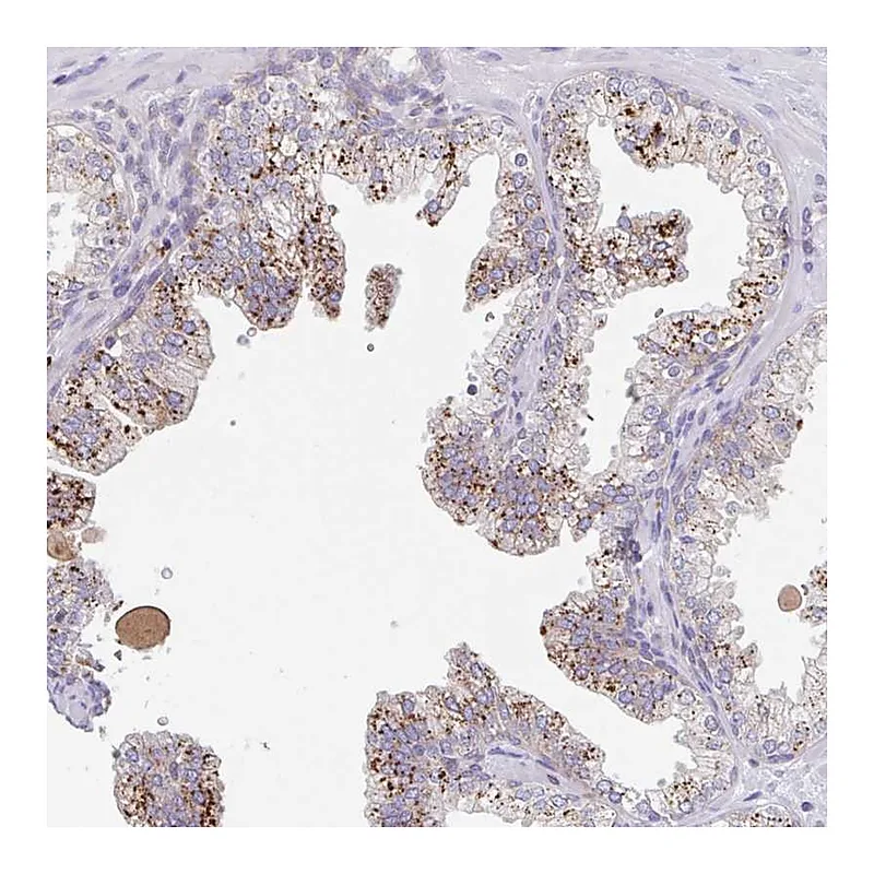 Atlas Antibodies Anti-MANBA Antibody