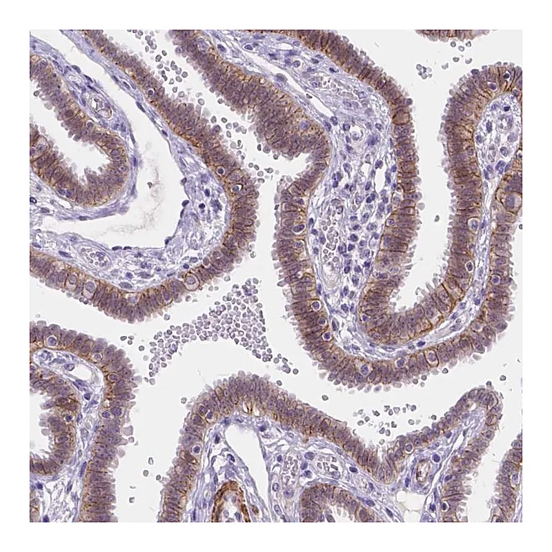 Atlas Antibodies Anti-MAN2C1 Antibody