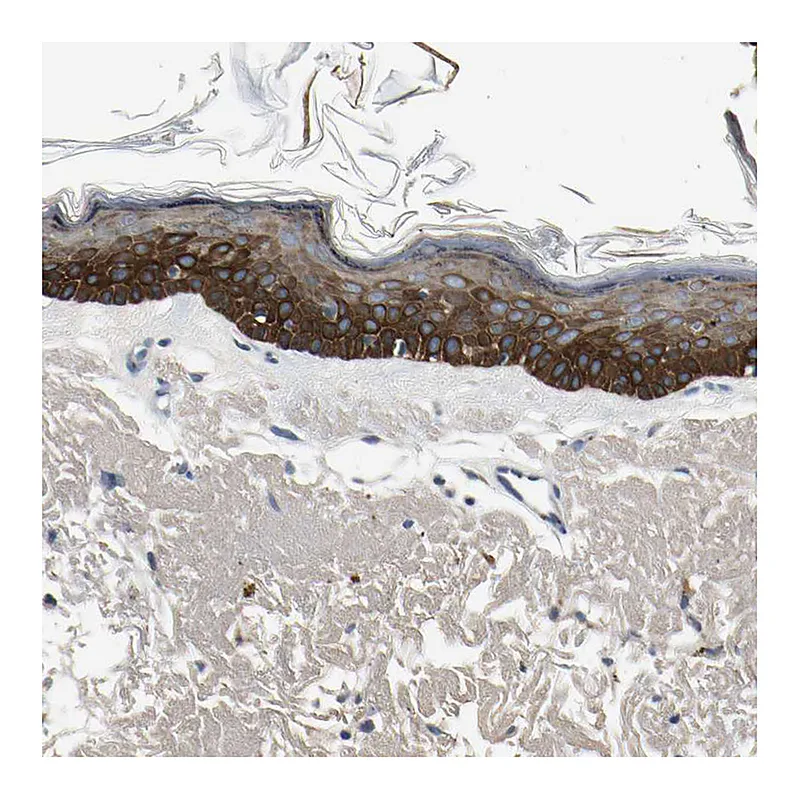 Atlas Antibodies Anti-MANSC1 Antibody