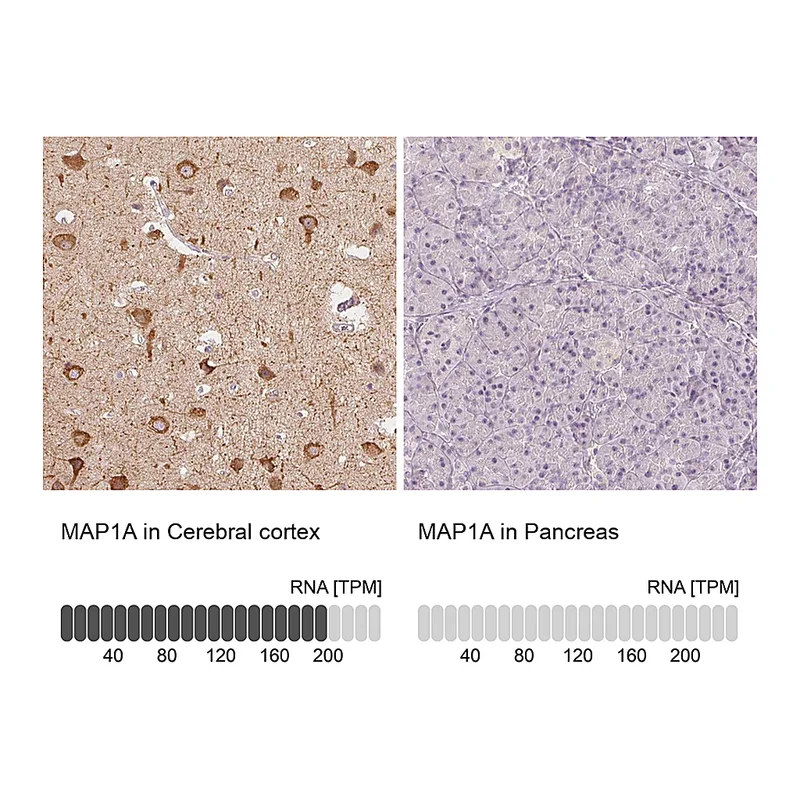 Atlas Antibodies Anti-MAP1A Antibody