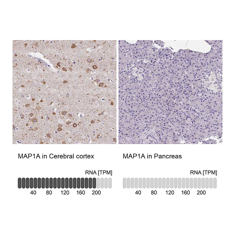 Atlas Antibodies Anti-MAP1A Antibody