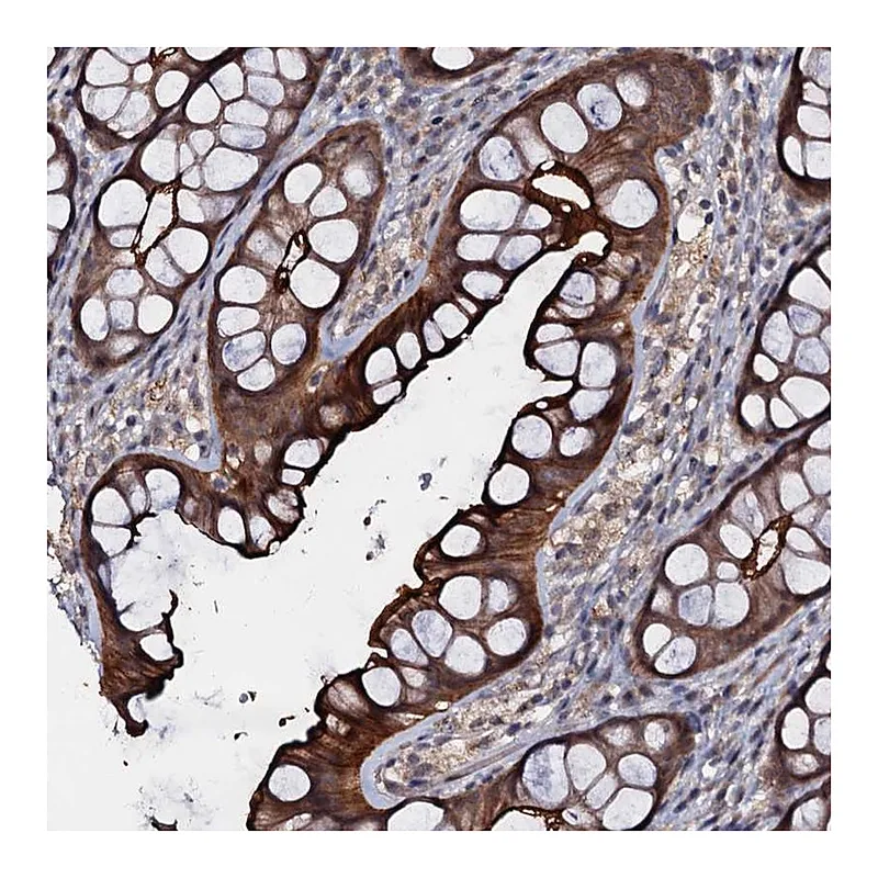 Atlas Antibodies Anti-MANSC4 Antibody