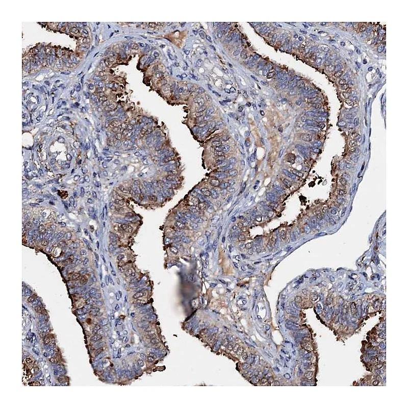 Atlas Antibodies Anti-MANSC4 Antibody
