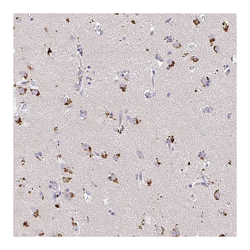 Atlas Antibodies Anti-MAP1LC3A Antibody