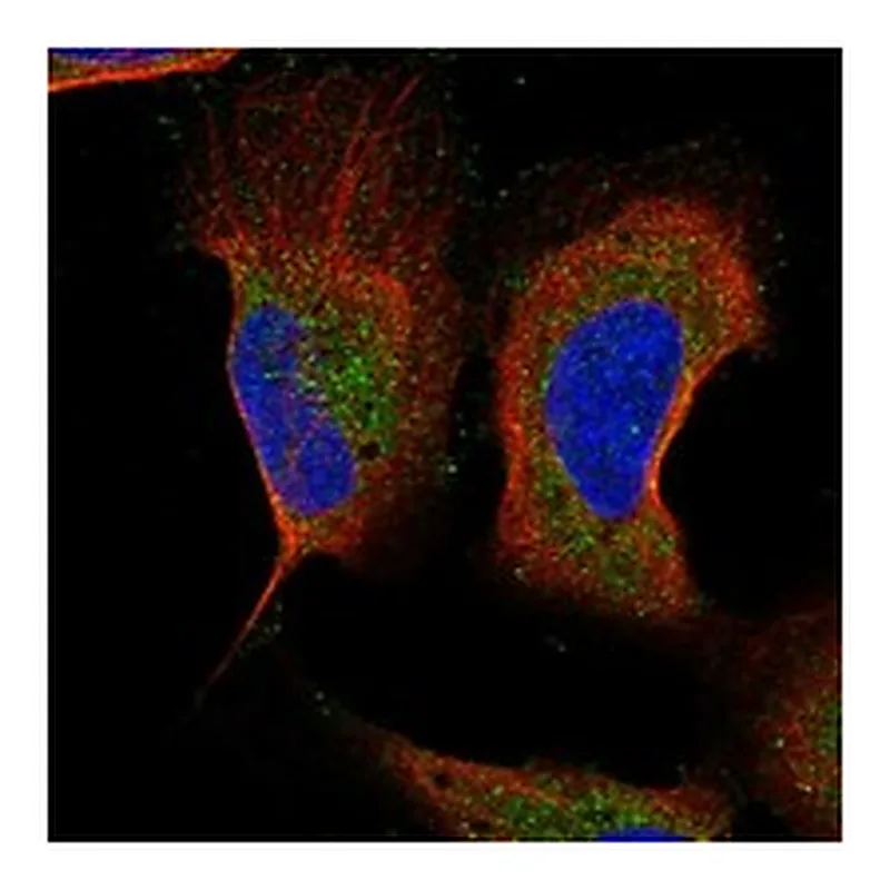 Atlas Antibodies Anti-MAP1LC3B Antibody