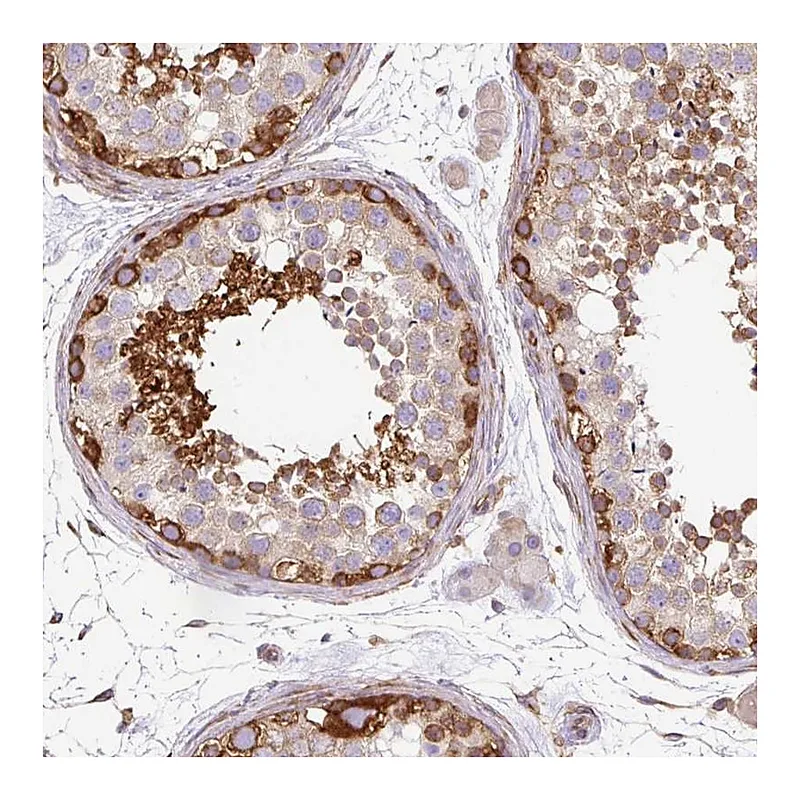Atlas Antibodies Anti-MAP1S Antibody
