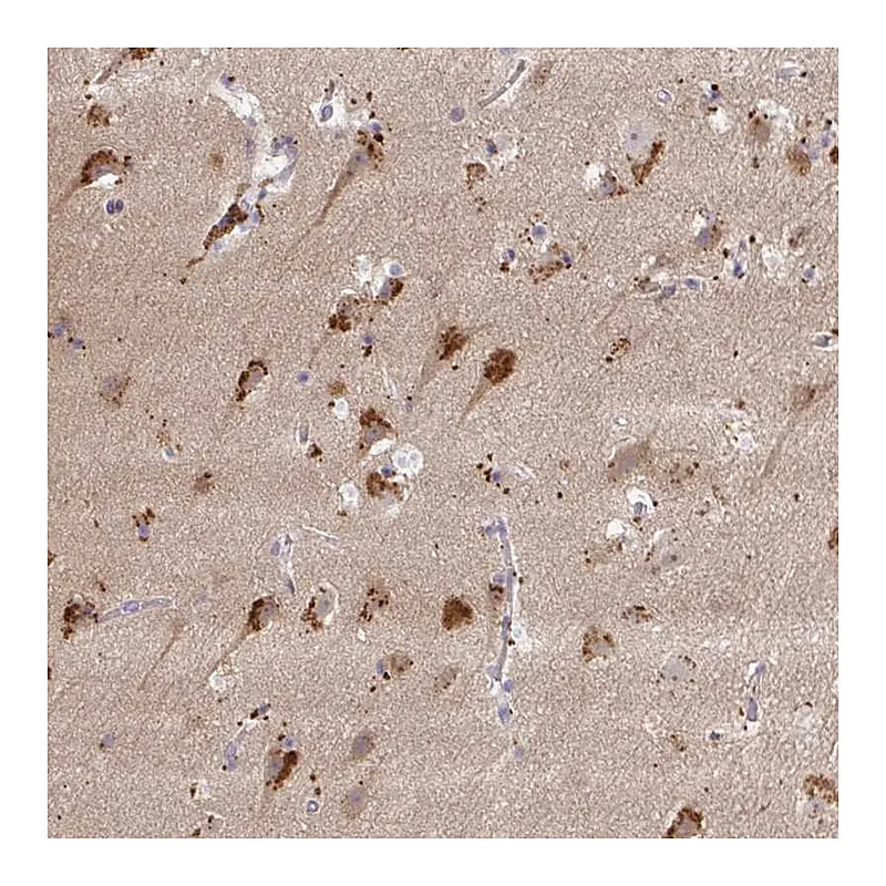 Atlas Antibodies Anti-MAP1LC3A Antibody