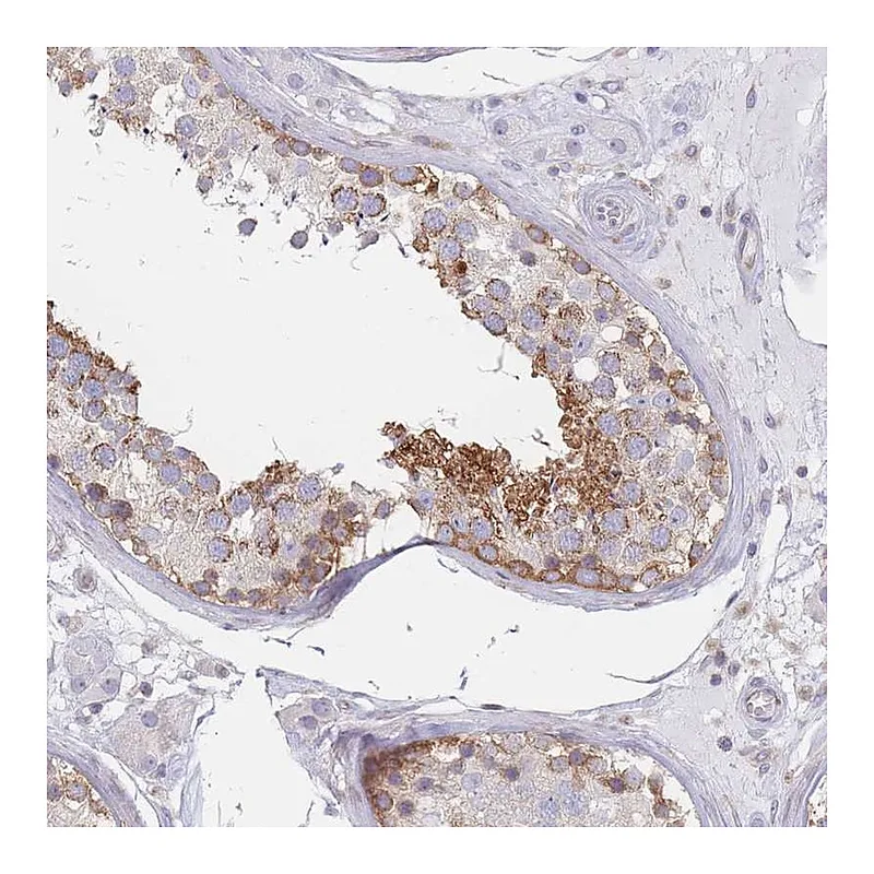 Atlas Antibodies Anti-MAP1S Antibody