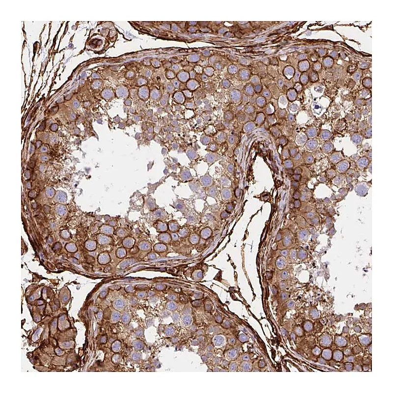 Atlas Antibodies Anti-MAP1LC3B Antibody
