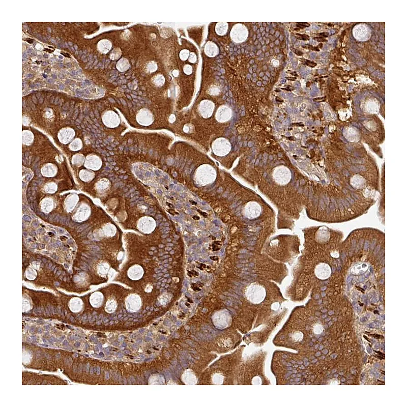 Atlas Antibodies Anti-MAP2K2 Antibody