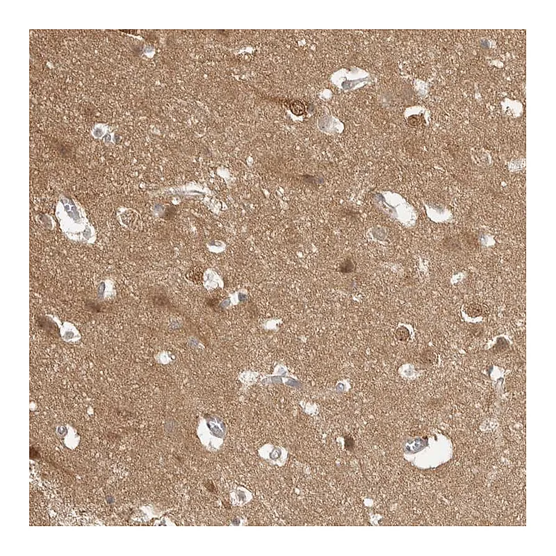 Atlas Antibodies Anti-MAP2K1 Antibody