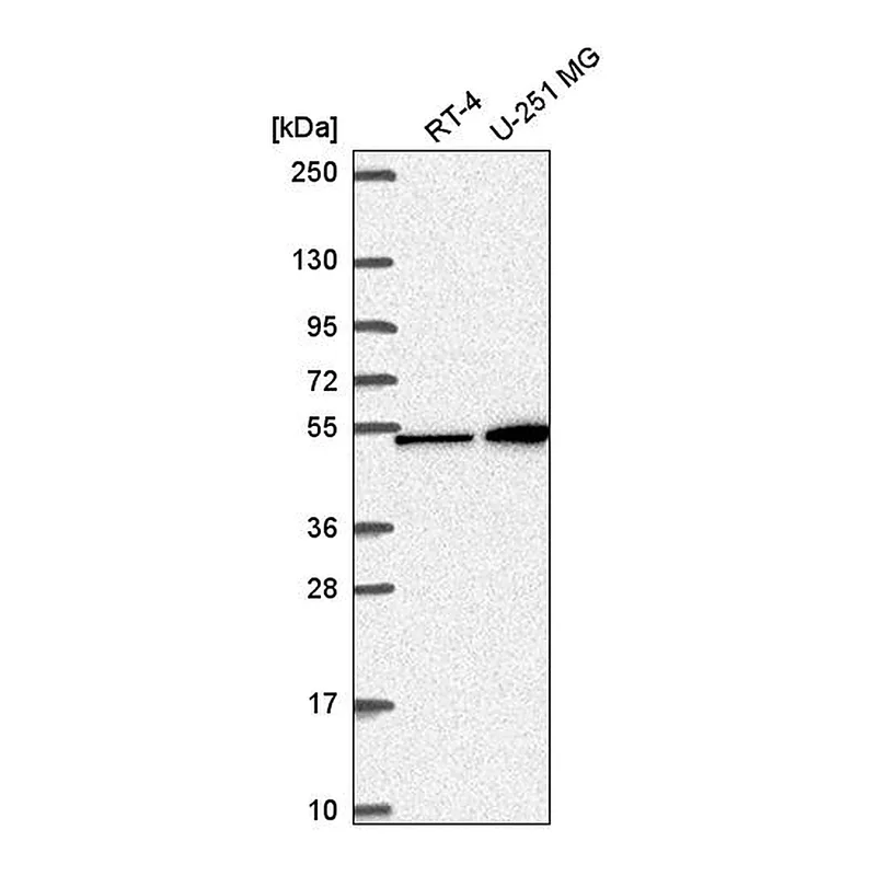 Atlas Antibodies Anti-MAP2K4 Antibody