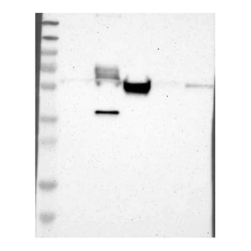 Atlas Antibodies Anti-MAP2 Antibody