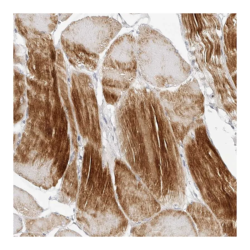 Atlas Antibodies Anti-MAP2K5 Antibody